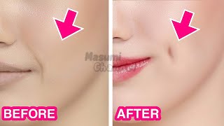 5mins Dimples Exercise Simple Facial Exercises to get Dimples without Surgery [upl. by Palestine373]