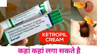 Ketoconazole Neomycin Iodochlorhydroxyquinoline Tolnaftate amp Clobetasol Propionate Cream Ketropil [upl. by Lori]