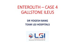 ENTEROLITH CASE 4  GALLSTONE ILEUS [upl. by Short]