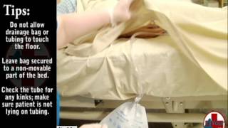 Instructional Video for Empty Urinary Drainage Bag [upl. by Nosdrahcir205]