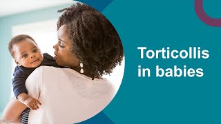 Torticollis in babies Neck movement and head shape [upl. by Pittman]