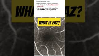 What is foveal vascular zone FAZ in retina retina opthalmology [upl. by Saree508]