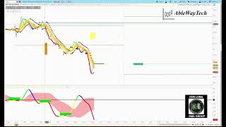 Case Study  DIA 82824 SSC and CD Pattern [upl. by Grunenwald76]