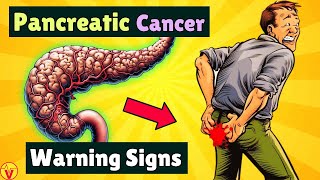 10 Warning Signs of PANCREATIC CANCER That Will SHOCK You  VisitJoy [upl. by Erait]