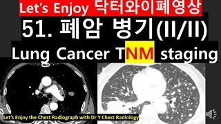 51폐암 병기 9th TNM CT 사진lung cancer staging 9th TNM폐암TNM9th병기폐암진단 폐결절DrYchestradiology닥터와이폐영상 [upl. by Anelad546]