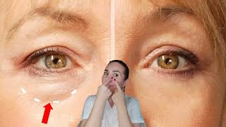 Reduce UNDER EYE BAGS and dark circles naturally [upl. by Nahsed799]