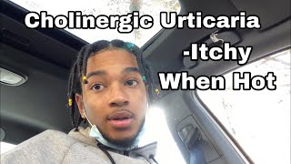 THE DOCTOR TOLD ME I HAVE CHOLINERGIC URTICARIA [upl. by Estrin924]