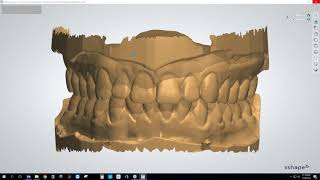 Webinar Making Clear Aligners Using the 3Shape Ortho System Module with Brandon Smith CDT [upl. by Damalas374]