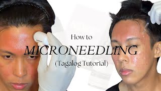 How to Microneedling Tagalog using New Skin New Me  Acne Scar Repair Kit by TCC [upl. by Wilterdink]