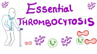 Essential Thrombocytosis ET  Myeloproliferative Neoplasm JAK2 Kinase [upl. by Callum]