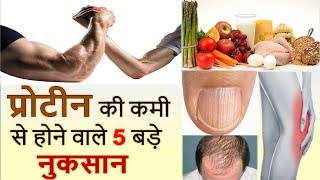 Top 5 Protein Deficiency Symptoms You Need To Know in Hindi  HEALTH JAGRAN [upl. by Eked]