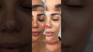 Step by Step Facial at home  Neud Diamond Facial kit ashortaday skincare trending [upl. by Aderfla597]