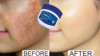 Vaseline for face pigmentation overnight  Vaseline on face at night benefits  Vaseline on face [upl. by Atnuahs857]