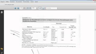 curso de Citogenetica Deleções [upl. by Hurlee]