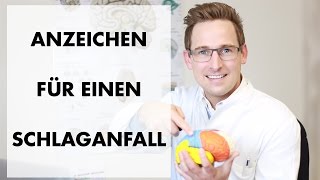 Anzeichen für Schlaganfall 51 Symptome [upl. by Haimerej673]