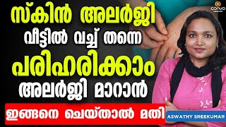 സ്കിൻ അലർജി വീട്ടിൽ വച്ച് തന്നെ പരിഹരിക്കാം ഇങ്ങനെ ചെയ്‌താൽ മതി  skin allergy treatment at home [upl. by Aholla]