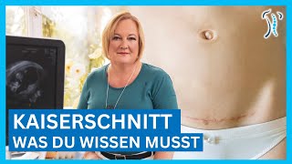 Gynäkologin erklärt Kaiserschnitt  Ablauf Narbe amp Heilung – Was du wissen musst [upl. by Laughlin]