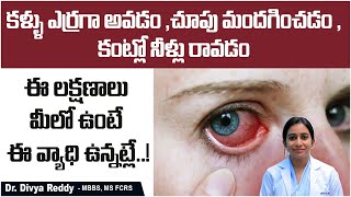 Uveitis Causes Symptoms and Treatment In Telugu  కంటిలో నల్ల మచ్చలు  Best Vision Eye Hospital [upl. by Hyacinthe]