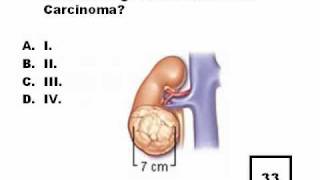 RENAL ULTRASOUND QUESTIONS 3wmv [upl. by Lali858]