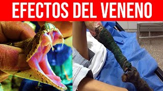 ¿Qué Pasa en tu Cuerpo si te Muerde una Serpiente Emponzoñamiento Ofídico Parte 2  Mentes Médicas [upl. by Swetlana]