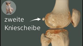 Die zweite Kniescheibe  die Fabella anatomie medizin anatomy [upl. by Baxie690]