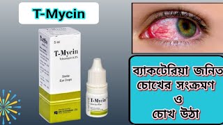 Tmycin ointment Tobramycin 03  Eye Drops  চোখ উঠা [upl. by Ddot]