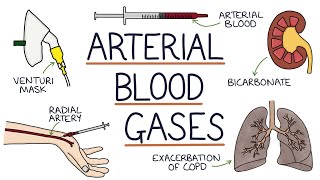 Understanding Arterial Blood Gases [upl. by Aniras]