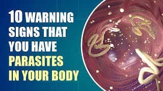 Dont Ignore These Early Symptoms of Parasites In Your Body [upl. by Notnel]