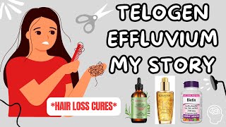 Telogen Effluvium Recovery  REGROWTH TIPS [upl. by Edvard]