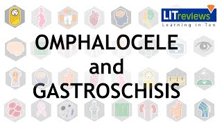 Omphalocele and Gastroschisis [upl. by Anayad]