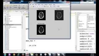 Denoising MRI images for removing rician gaussian and impulsive noise [upl. by Atirahc206]