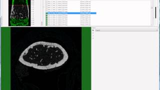 Bruker microCT tutorial Setting the trabecular VOI for the mouse femur [upl. by Nylirak]