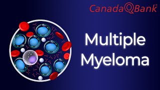 Multiple Myeloma [upl. by Xenos890]