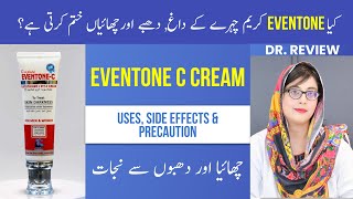 Eventone c cream  How To Use Side Effects In Detail  Dr Review [upl. by Elo130]