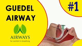 Guedel Airway  Oropharyngeal Airway [upl. by Ameg41]