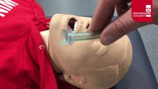 Nasopharyngeal Airway Insertion [upl. by Otrebtuc]