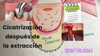 Cicatrización después de una extracción dental [upl. by Ivan]