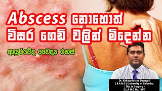 Abscess  විසර ගෙඩි රෝගයට නොවරදින ආර්යුවේද පිළියම්  Dr Abhayathilaka Dewagiri [upl. by Anomor628]