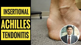 Insertional Achilles Tendinitis How to Diagnose [upl. by Trebeh]