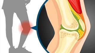 Sliding filament theory in muscle contraction  Wellcome [upl. by Elodie76]