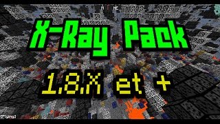 REALEASE PACK  XRAY PACK 18X et [upl. by Rez]