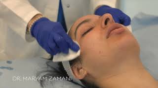 Mandelic Acid Peel for Brightening  Dr Maryam Zamani [upl. by Nylorak]