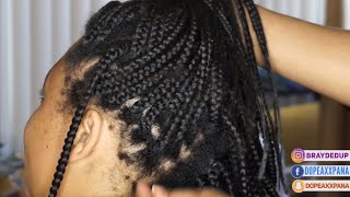 OMG 2 12 Month Old Box Braid Take Down So Much BREAKAGE  Hair Growth Transformation 2 [upl. by Ygiaf631]