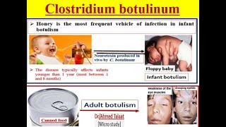 Clostridium botulinum Botulism disease quotMedical microbiology [upl. by Nedla98]