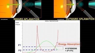 How does ocular response analyser works [upl. by Iver]