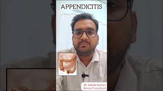 Acute appendicitis treatment I Treatment for acute appendicitis in Delhi Noida [upl. by Shornick681]