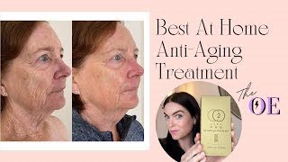 Best At Home AntiAging Treatment  CO2 Lift Pro Carboxy Therapy Mask [upl. by Engleman108]