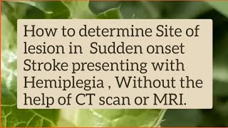 Stroke Localization in Hemiplegia  No CT Scan No MRI Help [upl. by Notelrahc]