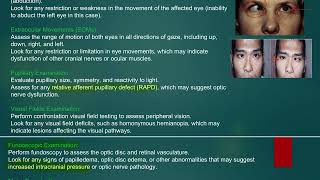 MRCP PACES NEUROLOGY STATION SIXTH NERVE PALSY [upl. by Ahsel]