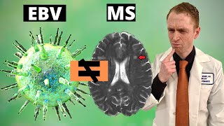 EBV Does Not Cause Multiple Sclerosis [upl. by Trici280]